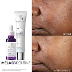 Kit anti manchas mela b3 serum y crema 30ml 40ml imagen 2