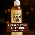 ELIMINA 95% DE ESTRIAS ACEITE DE PATA DE VACA MASERADO 100% NATURAL imagen 4