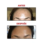 ACIDO GLICOLICO 7% THE ORDINARY imagen 4